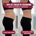 Culotte Gainante 360° — Post-Partum