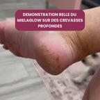 Miela Glow